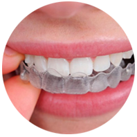 Placas de descarga dentales